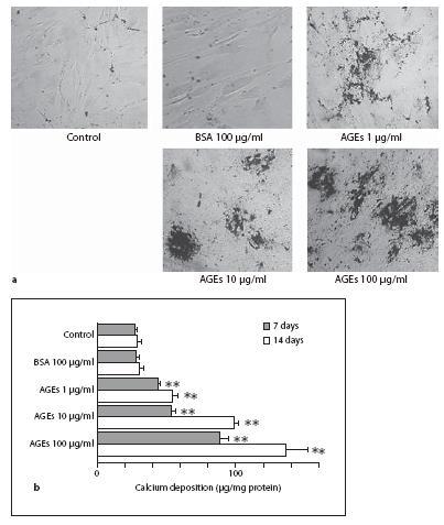 Advanced glycation end products induce calcification of VSMC through RAGE/p38MAPK and