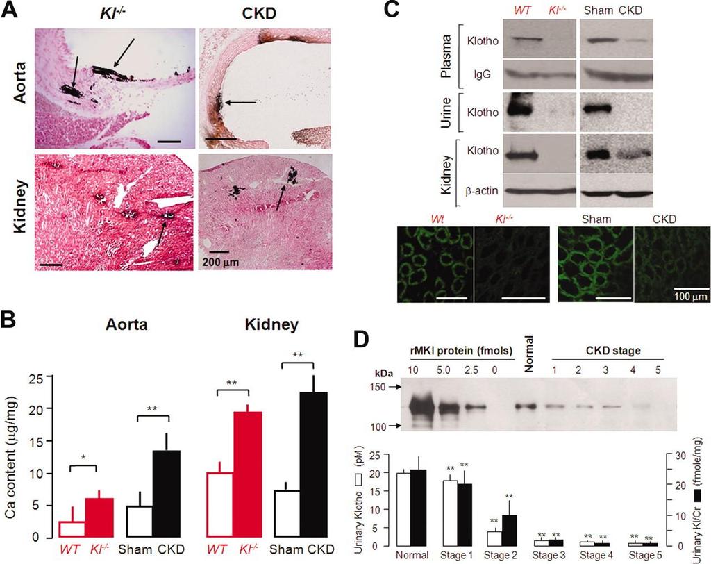 Klotho levels are reduced in CKD mice and CKD patients, and soft tissue