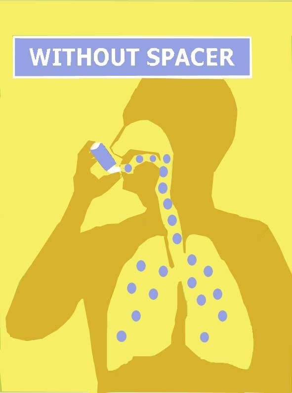 hitting the back of your mouth. Always use your inhaler with a SPACER! Take ACTION!