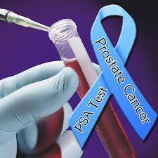 PSA: PROSTATE SPECIFIC ANTIGEN The PSA test and digital rectal exam (DRE) may be used to screen both asymptomatic and symptomatic men for prostate cancer.
