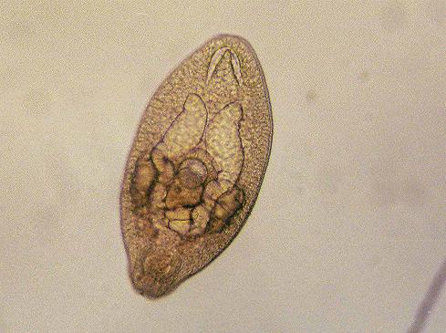 sporocyst -> redia -> cercaria (secondary