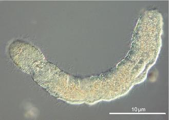 gastrotricha ectoprocta gnathifera annelida entoprocta lophotrochozoa