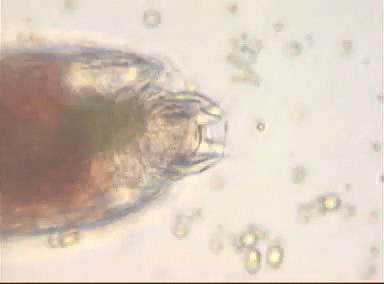 Rotifera rotifers general characteristics mastax Marine or freshwater