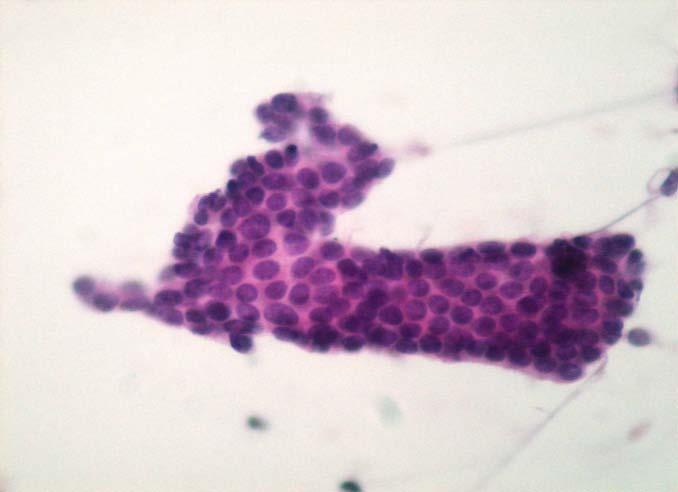 Cells arranged mostly in tubular structures with comma-like pattern.