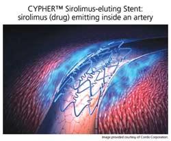 Area Shrinkage of LCX Ostium Sirolimus-Eluting Stent Cypher: Johnson and Johnson Everolimus-Eluting