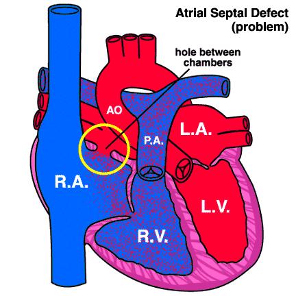 A brief overview of the most common congenital cardiac conditions 1.