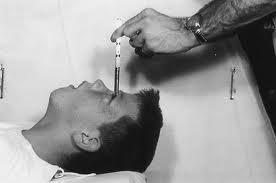 Lobotomy - A procedure that cut the nerves connecting the frontal