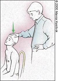 Special Testing Spurling s maneuver: extension and rotation of the neck with downward