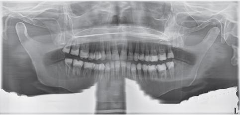 Lead Apron Artifact From Iannucci J, Jansen Howerton L: Dental radiography: principles and