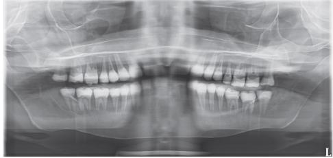 Reverse Smile Line From Iannucci J, Jansen Howerton L: Dental radiography: principles and