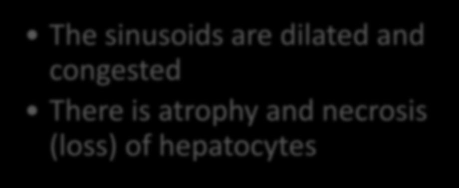 (midzonal) Hepatocytes