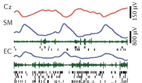 Comparison of electrophysiological recording EEG, LFP, MUA and single unit activity