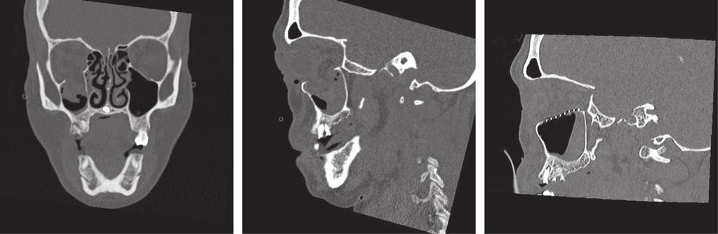 Facial fractures (c) Fig.