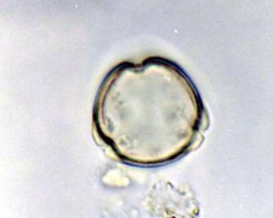 11); pollen axis 27 µm (20(23) 26µm); tricolporate; colpus margins irregular; pore lalongate (4x5