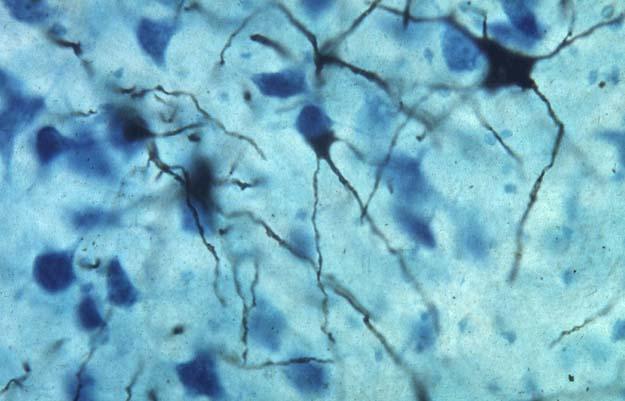 Photograph of neurons stained by Golgi s method which fills processes of some cells with black