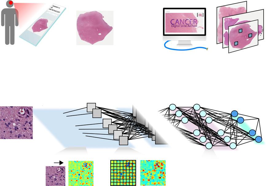 A Whole-slide imaging B Region of interest selection Resection / biopsy C Survival Convolutional Neural Network (SCNN) Prediction error (negative log-likelihood) Convolutional layers Fully connected