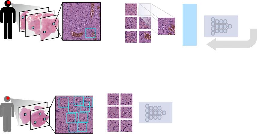 The SCNN combines deep learning CNNs with traditional survival models to learn survival-related patterns from histology images.