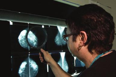 It will not take long. A radiologist (who is a doctor who specialises in reading x-rays) and specialised film reading mammographers, will report on your films. How do I receive my results?