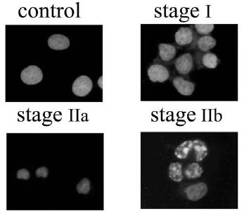 Bcl2 Proteins Caspase Regulation MITOCHONDRIA AND APOPTOTIC DEATH zymogen Apaf1 Casp9 XIAP Active caspase Diablo BCL2 mitochondrion BCL2 BAK Casp3/7 ciap1/2 HtrA2 CASPASE 3,6,7 ACTIVATION casp1/2