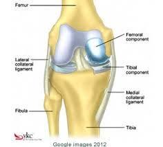 Arthritis: Treatment: Total Knee
