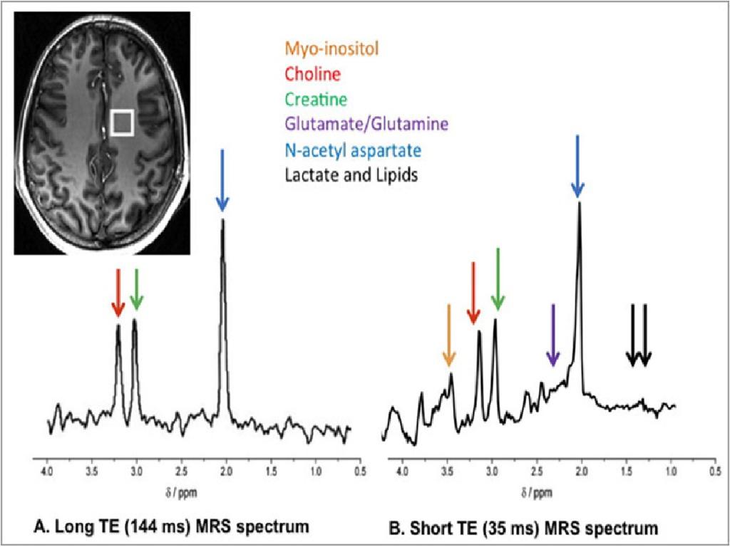 Fig. 1: Magnetic ResonanceSpectroscopy