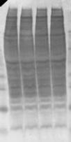 Shown are representative bcl-2 blots with coomassie brilliant blue stain for loading.