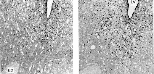 Fos immunostaining induced by i.c.v. d-amphetamine Number of c-fos IR Cells 5 4 3 2 1 N.