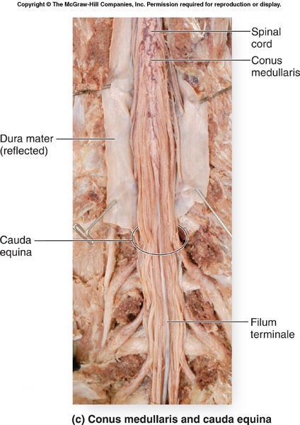 Structure of the Spinal Cord The spinal cord is shorter than the vertebral canal that houses it.