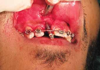 10: Post-treatment intraoral frontal photograph Fig.