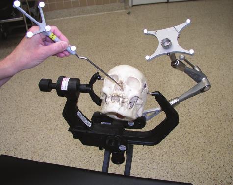 Intraoperative 3D imaging in transsphenoidal pituitary surgery FIG. 1. Photograph of a dehydrated human skull in a radiolucent head holder, used for initial testing of Arcadis Orbic equipment.