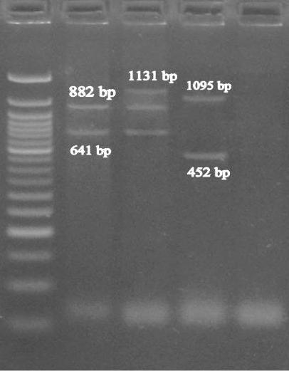 EXPRESSION PROFILING OF CREM GENE IN TESTIS 205 1 2 3 4 5 1350 bp 916 bp 500 bp 200 bp Fig.