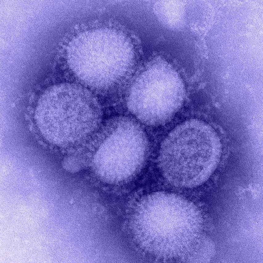 17 2009 H1N1 Achievements Rapidly identified novel influenza virus Developed and distributed diagnostic