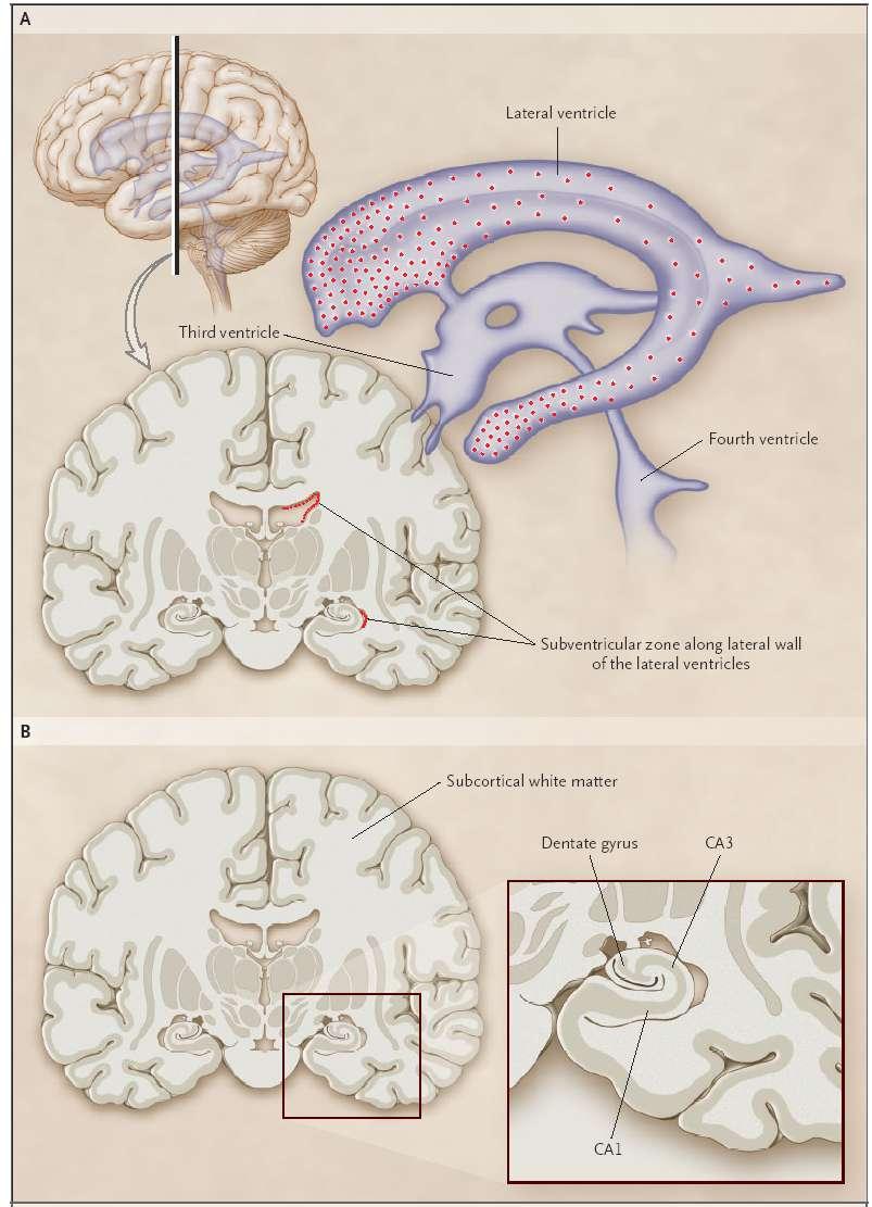 Neural Tumors Preferentially Form