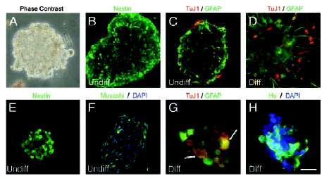 differentiated astrocytes produces gliomas in rat.