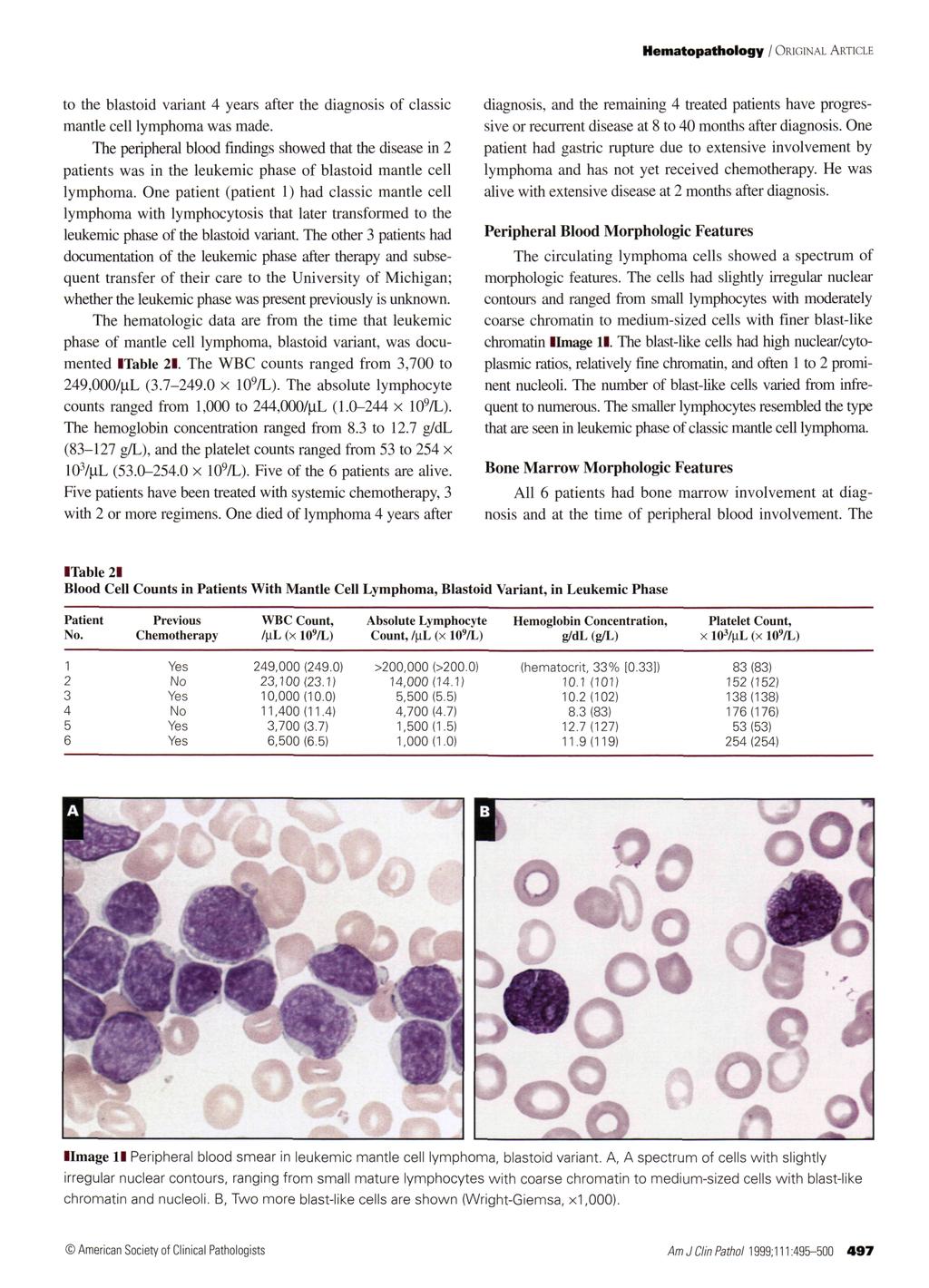Hematopathology / ORIGINAL ARTICLE diagnosis, and the remaining 4 treated patients have progressive or recurrent disease at 8 to 40 months after diagnosis.