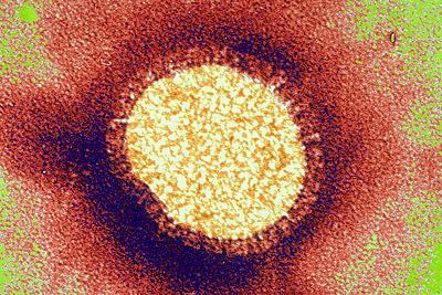 What Is A Variant Virus? Swine influenza viruses do not normally infect humans. However when sporadic human infection occurs, these viruses are called variant viruses.