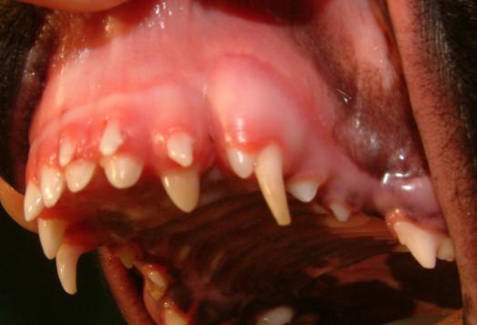 Retained deciduous teeth- intervene (xray & extract) if deciduous teeth not