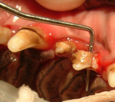Missing tooth dentigerous cyst: investigate (FNA, biopsy) & cyst enucleation. Warning!