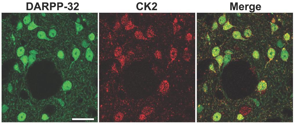 Supplementary Figure 13: Localization of CK2 in the striatum. Sections from mouse striatum were immunostained for DARPP-32 (green) and CK2 alpha subunit (red).