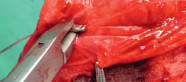 Cut off the free ends close to the crimp. The crimp should sit over tibialis cranialis muscle close to the tibia.