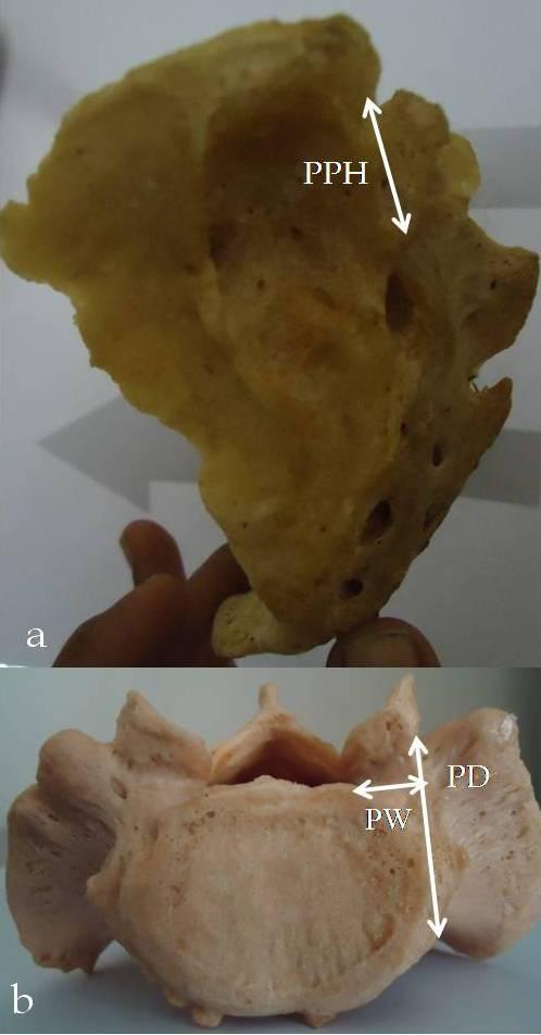 Chhattisgarh. Random samples were taken and were classified on the basis of sacral index. There were 38 male and 12 female specimens. Eroded and damaged bones were excluded from study.