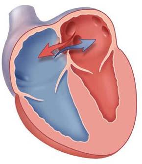 Part 4: Coronary Artery