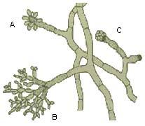 Cladophialophora carrionii