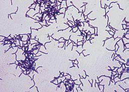 Gram stain morphology Actinomyces species
