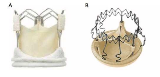 Suturless Aortic valve Perceval S (Sorin, Saluggia, Italy) It utilizes the memory of the nitinol metal frame, which deploys and