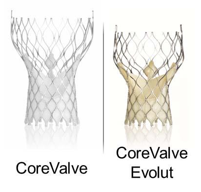 CoreValve in a Degenerative Surgical Valves CoreValve \ CoreValve Evolut TM Design Principle features: Tailored height and shape Conformability and sealing Optimized radial