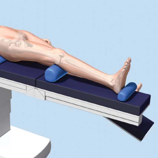 Opening the Tibia 1 Position patient Position the patient supine on the radiolucent table. Ensure that the knee of the injured leg can be flexed 10-20.