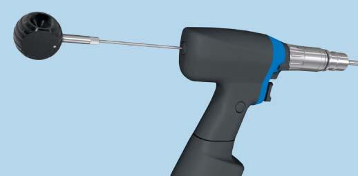 5 mm diameter reaming head, ream to a diameter of 0.50 mm 1.0 mm greater than the nail diameter.