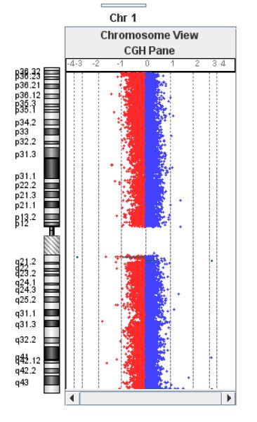 28. ST-260 ženska ispitanica, 26 godina. Uputna dijagnoza: RIP. Uredan nalaz analize G-pruga. MLPA analizom mikrodelecijskog seta proba P297 utvrđena je delecija CD160 gena (Slika 72a.).