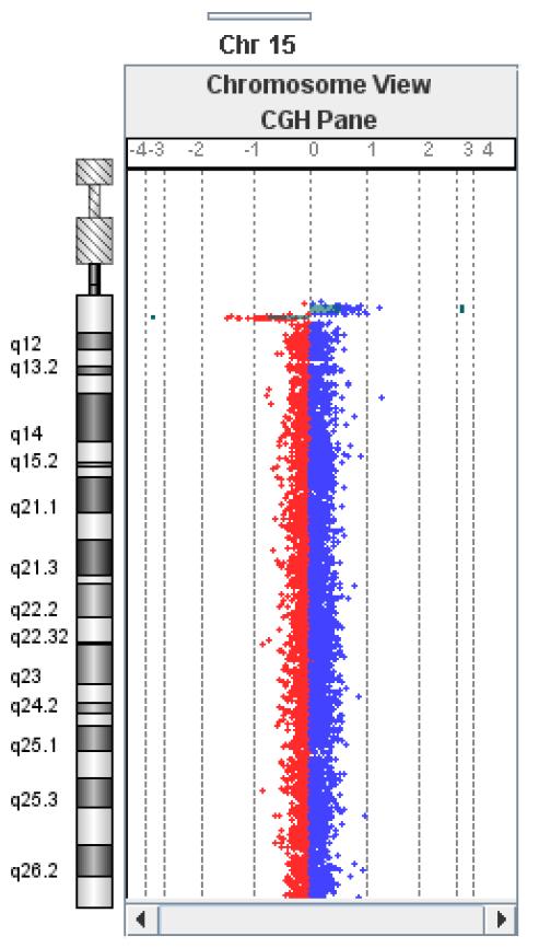 FISH analizom potvrđena je delcija (Slika 84.). Postavljena je dijagnoza 15q11 mikrodelecijskog sindroma (80). a Slika 88. (a) Shematski prikaz array rezultata za kromosom 15.